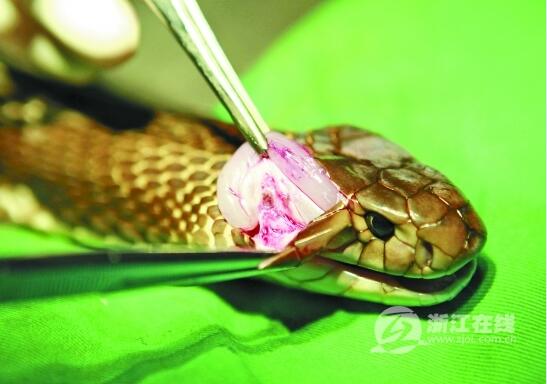 给眼镜蛇做去毒腺手术谈、40分钟手术眼镜蛇头上拔毒！