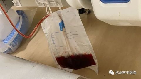 可怕!马蜂袭击毒性不能忽视!堪比眼镜蛇!