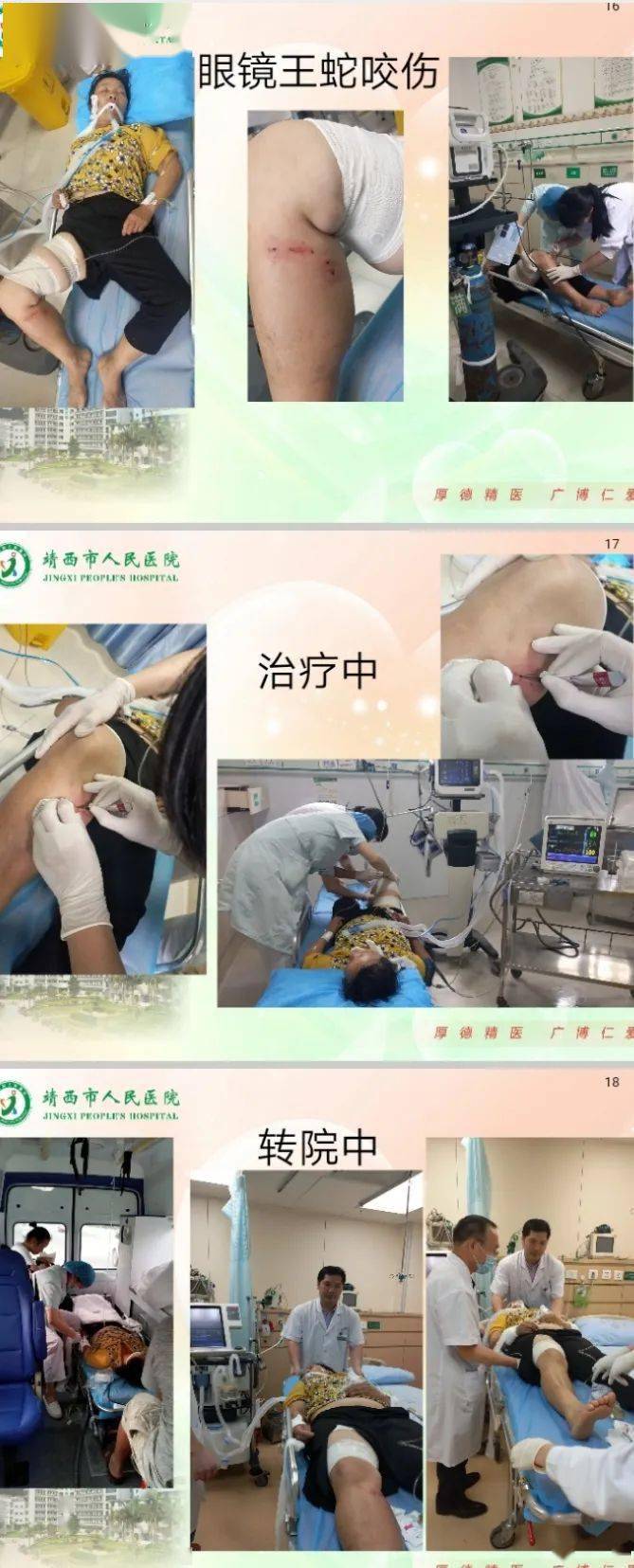 桂西毒蛇咬伤救治中心——靖西救治点获专家肯定