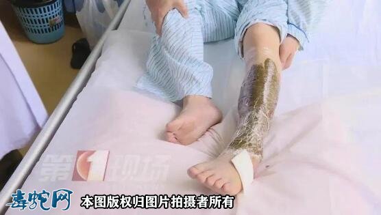 深圳半个月内14人被毒蛇咬伤!夏季外出要谨慎!
