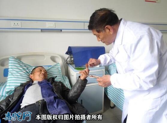 毒蛇伤人频发！安徽歙县67岁老人被眼镜蛇咬伤急救！