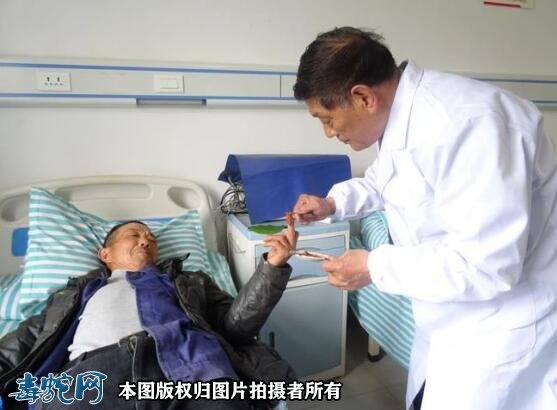 毒蛇伤人频发!安徽歙县67岁老人被眼镜蛇咬伤急救!