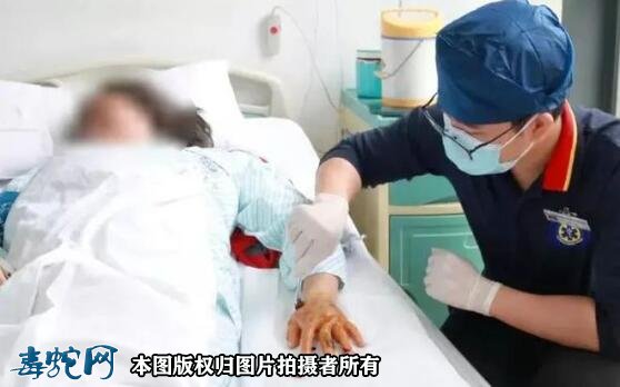 广东半个月内14人中招!广东毒蛇进入高发期、五一出游要注意!