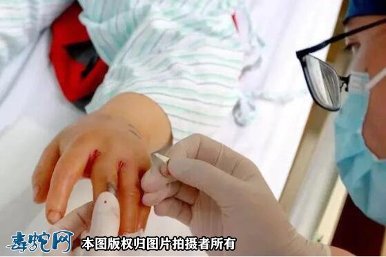 广东半个月内14人中招!广东毒蛇进入高发期、五一出游要注意!