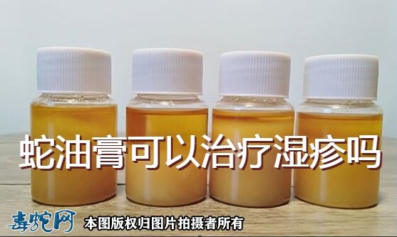 蛇油膏可以治疗湿疹吗