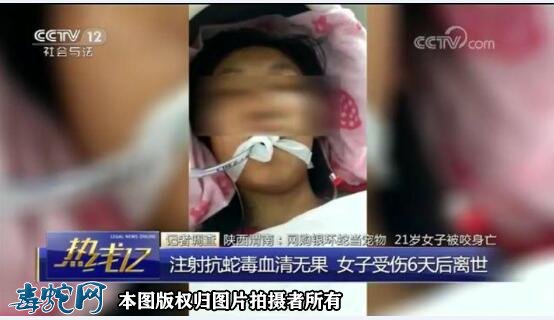 银环蛇血清为啥缺?