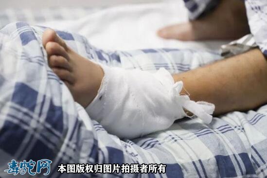 东莞市本月也有5列毒蛇咬伤!谢岗医院储备抗蛇毒血清!