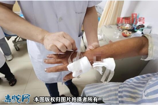 柳州多起毒蛇咬伤!电动车碾过毒蛇被反咬昏迷两天!