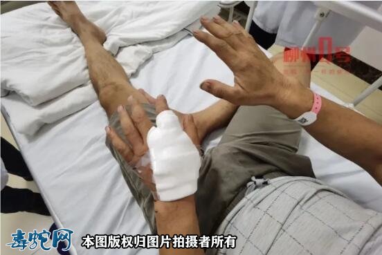柳州多起毒蛇咬伤!电动车碾过毒蛇被反咬昏迷两天!