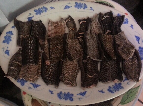吃蛇肉治疗牛皮癣