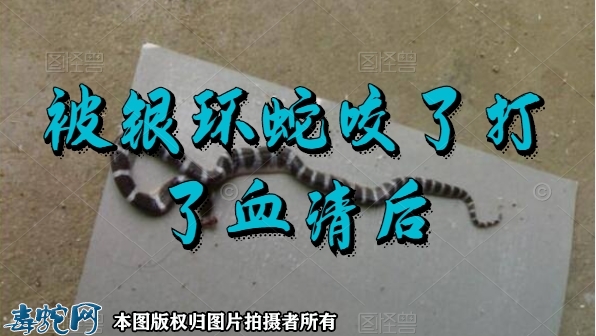 被银环蛇咬了打了血清多久见效？打血清...