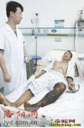 汝阳男子遭毒蛇咬伤 各方寻找“生命曙...