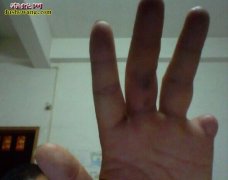 毒蛇咬死人