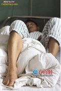 银环蛇咬伤人的图片
