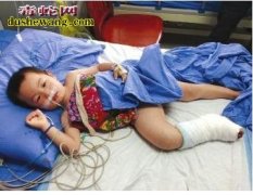 两幼儿家中玩耍被毒蛇咬伤 男童被毒蛇...