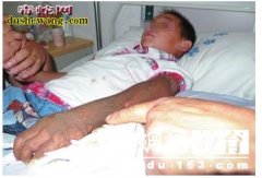 肇庆12岁男童被毒蛇咬伤 警方助其7...