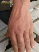 杭州老人抓蛇炖汤 杀蛇不慎被毒蛇咬伤...