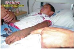遵义：毒蛇咬伤少年右腿 交警及时护送...