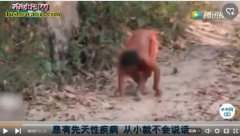 15岁男孩被遗弃与狗长大 走路四肢着...