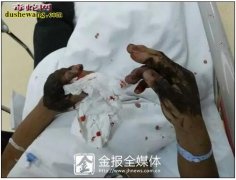 五步蛇抓不得：浙江男子徒手抓五步蛇双...