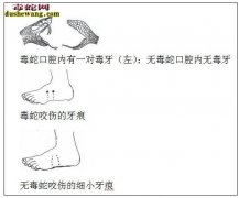 被蛇咬伤如何判断是否是毒蛇咬伤？