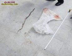 沪女子杀银环蛇取胆入药被咬伤昏迷！中...