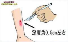 蛇伤急救知识与蛇伤急救盒使用方法