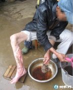 被眼镜蛇咬伤会这样！养毒蛇必须先学会...