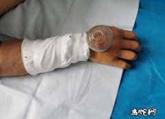 夏季到来警惕蛇出没！安徽近日多人被咬...