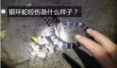 银环蛇咬伤样子？银环蛇咬伤是什么样子...