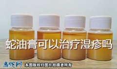 蛇油治疗湿疹、蛇油膏可以治疗湿疹吗？