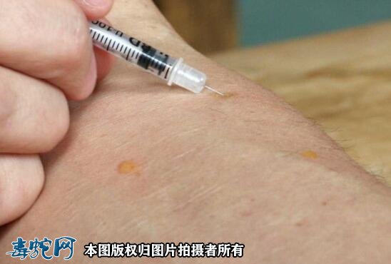 蛇毒能壮阳吗？
